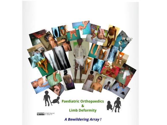 Paediatric Orthopaedics & Limb Deformity Spectrum
