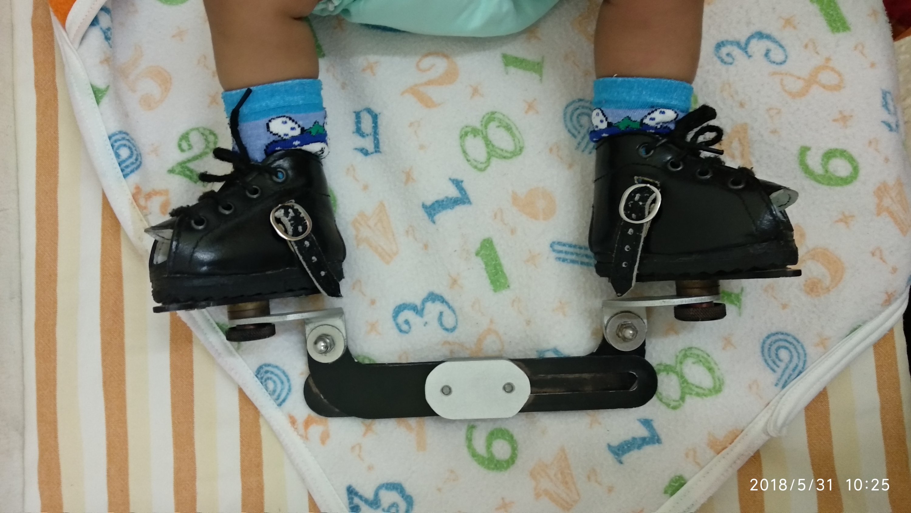 Dobbs brace for Clubfoot