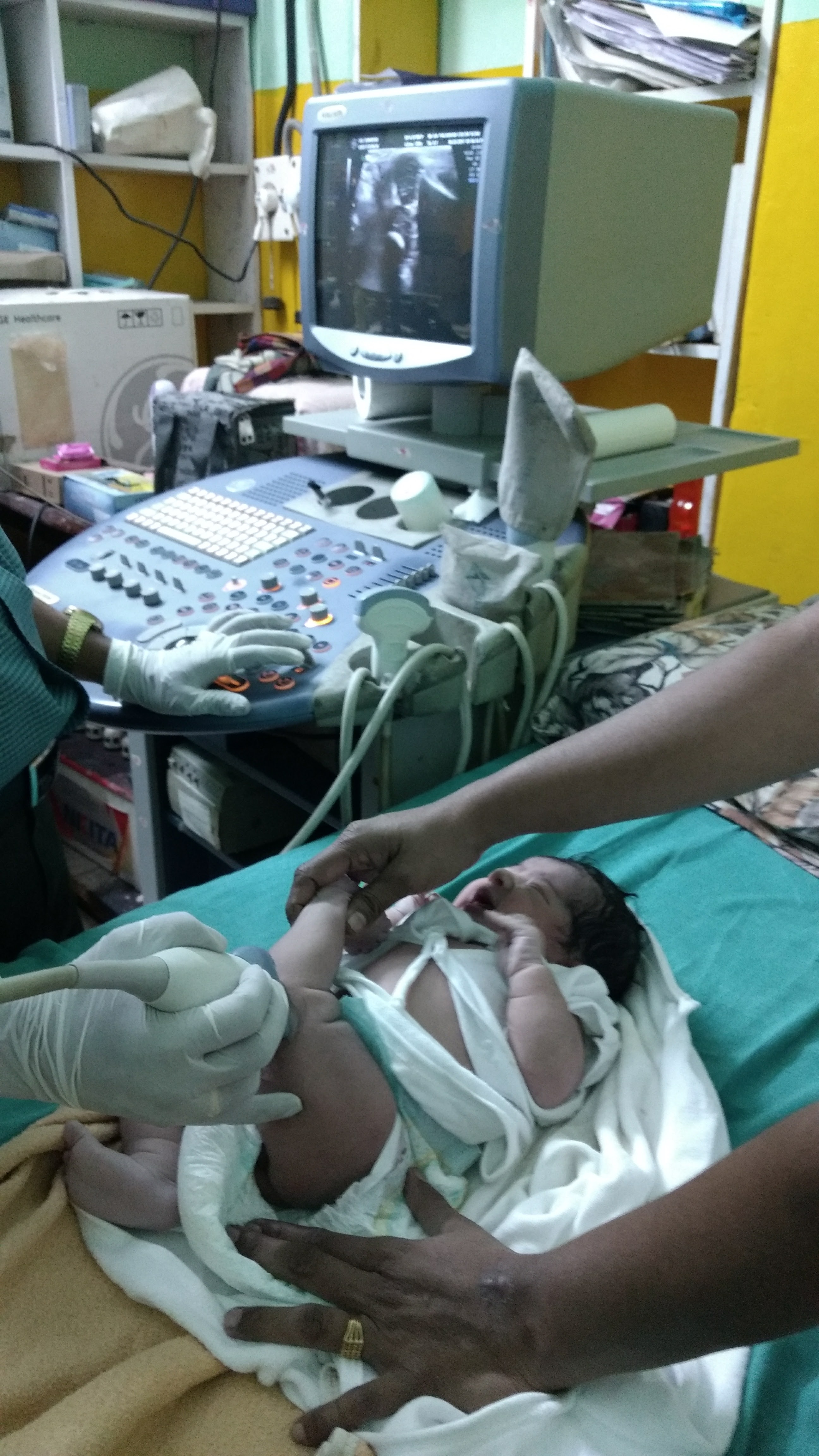 Ultrasound exam for a child with Hip and Knee dislocation